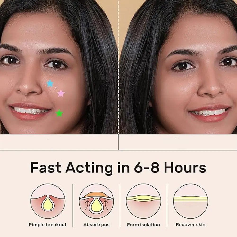 Colorful Star Acne Pimple Patch