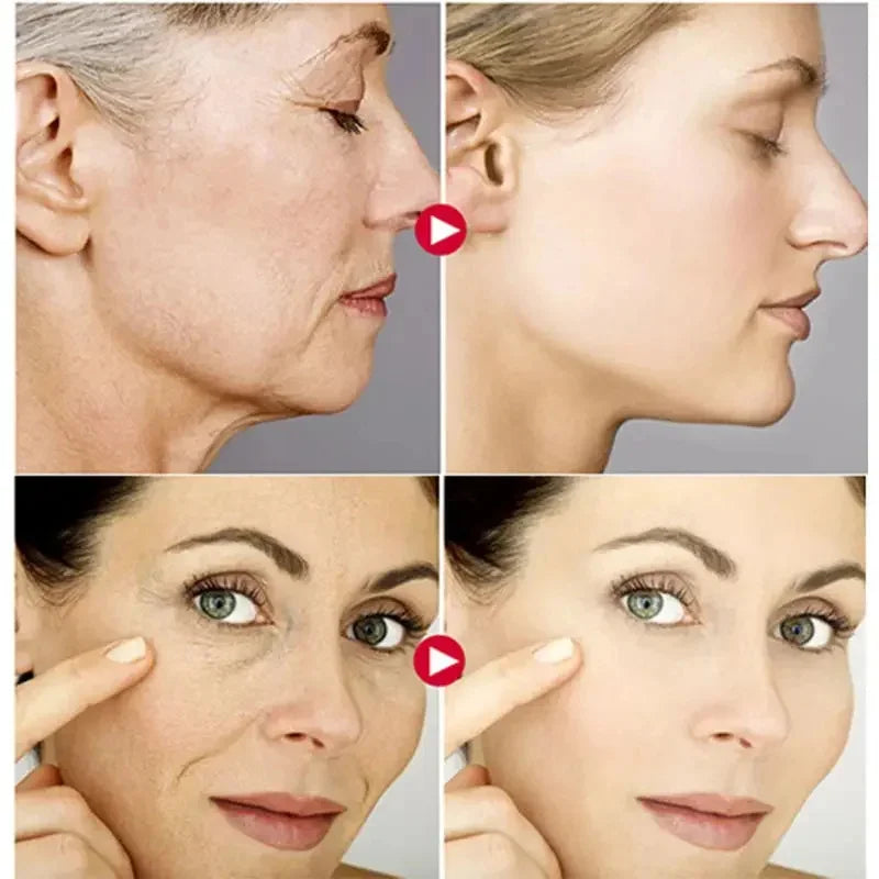 Retinol Wrinkle Removing Cream – Anti-Aging & Brightening