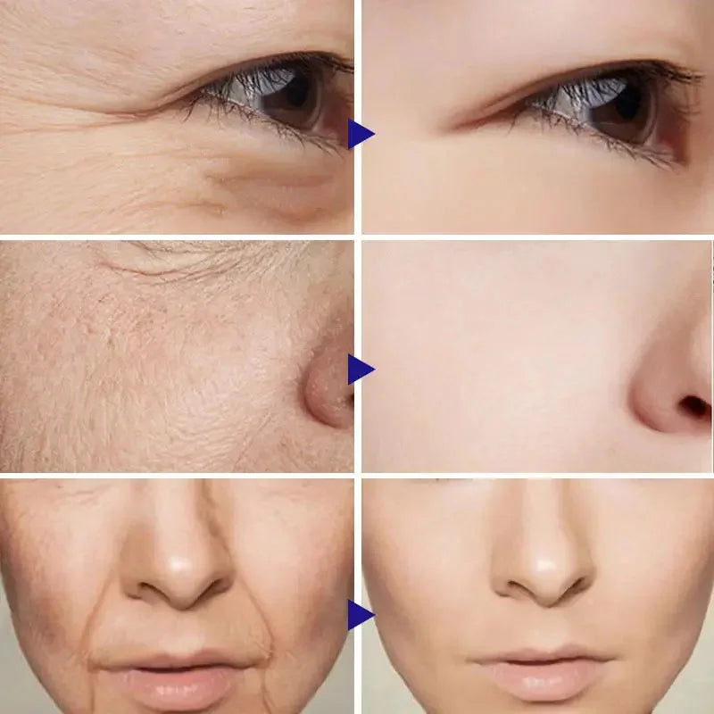 Retinol Wrinkle Removing Cream – Anti-Aging & Brightening
