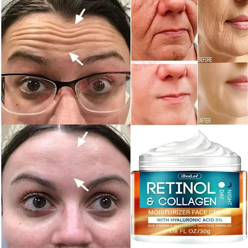 Retinol Wrinkle Removing Cream – Anti-Aging & Brightening