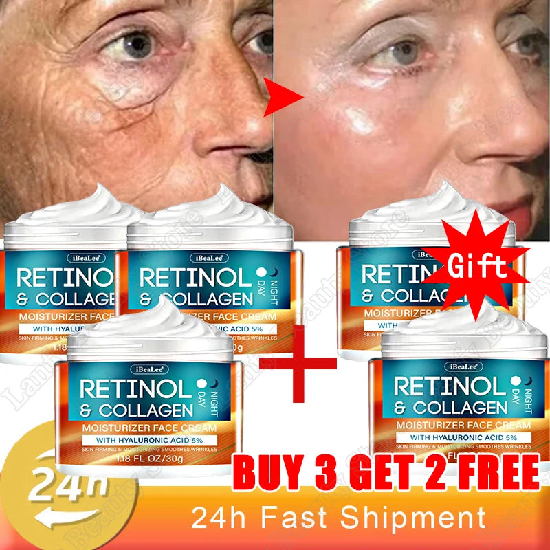 Retinol Wrinkle Removing Cream – Anti-Aging & Brightening