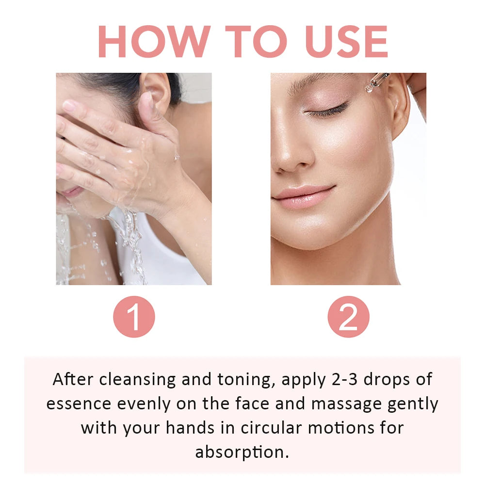 30ml Niacinamide Serum – Melanin Removal & Pore Shrinking