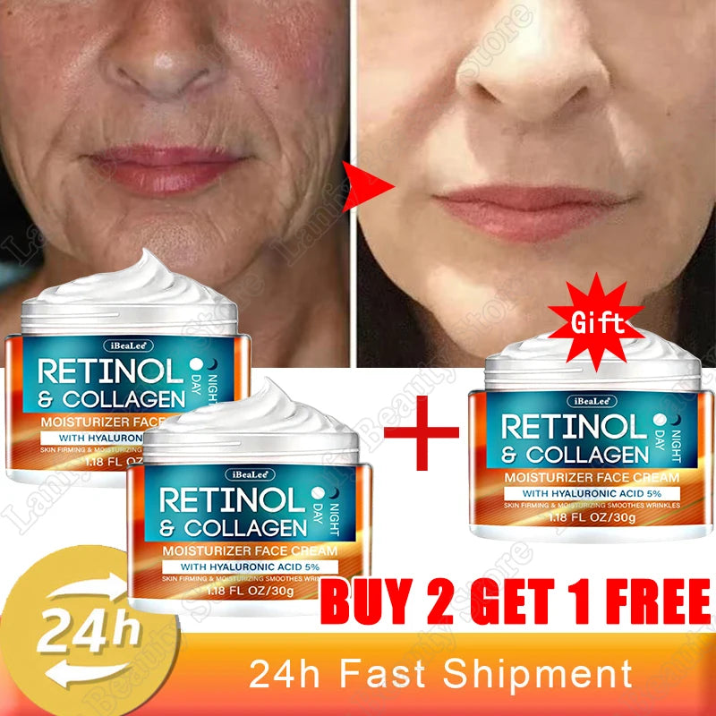 Retinol Wrinkle Removing Cream – Anti-Aging & Brightening