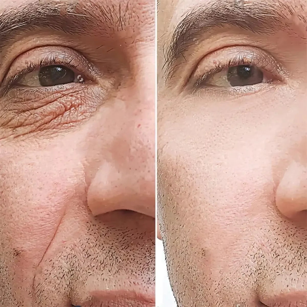 Retinol Anti-Wrinkle Cream for Men – Collagen & Firming