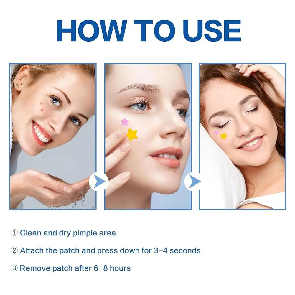 Colorful Star Acne Pimple Patch