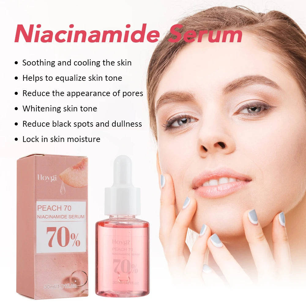 30ml Niacinamide Serum – Melanin Removal & Pore Shrinking