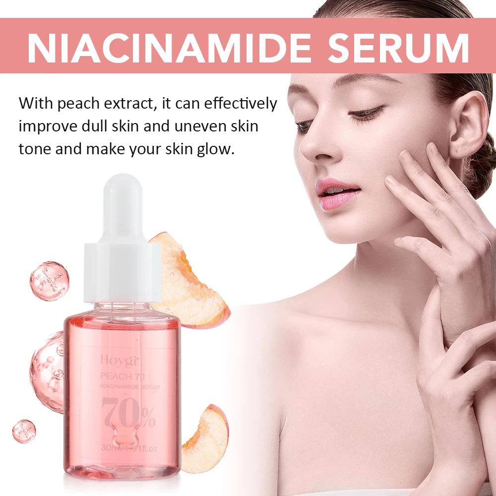 30ml Niacinamide Serum – Melanin Removal & Pore Shrinking