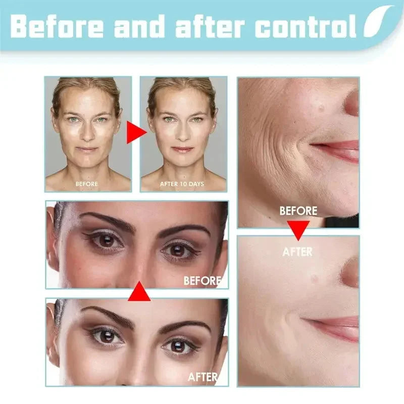 Retinol Wrinkle Removing Cream – Anti-Aging & Brightening