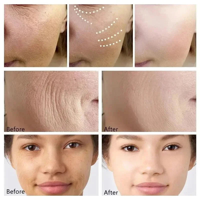 Retinol Wrinkle Removing Cream – Anti-Aging & Brightening