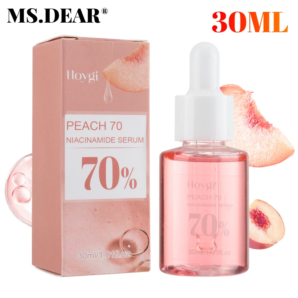 30ml Niacinamide Serum – Melanin Removal & Pore Shrinking