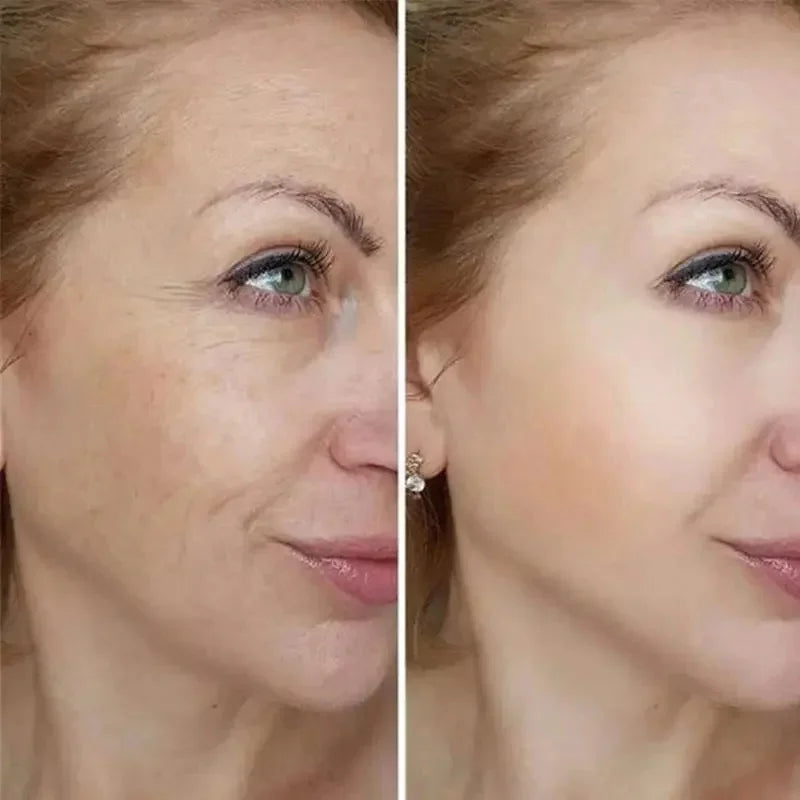 Retinol Wrinkle Removing Cream – Anti-Aging & Brightening