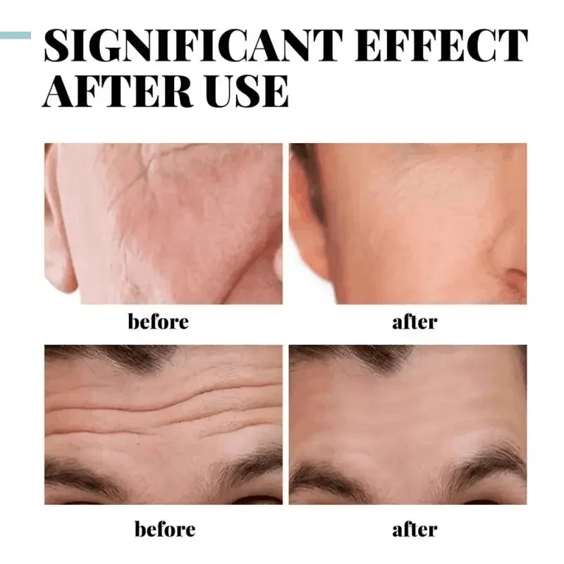 Retinol Anti-Wrinkle Cream for Men – Collagen & Firming