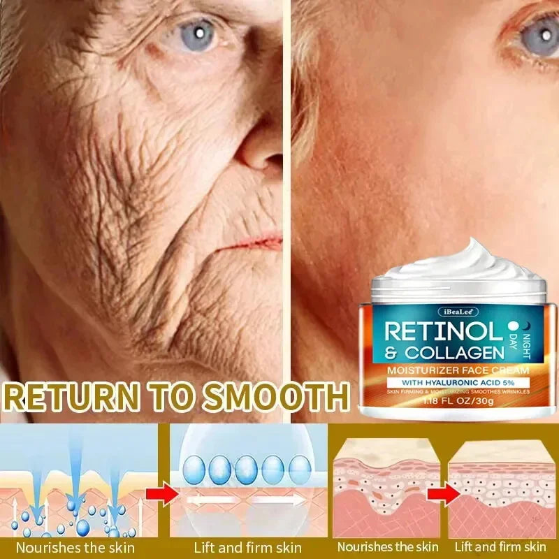 Retinol Wrinkle Removing Cream – Anti-Aging & Brightening
