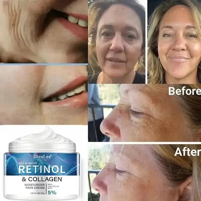 Retinol Anti-Wrinkle Cream for Men – Collagen & Firming