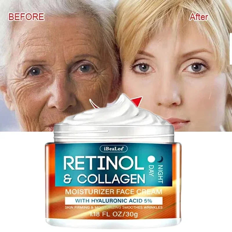 Retinol Wrinkle Removing Cream – Anti-Aging & Brightening