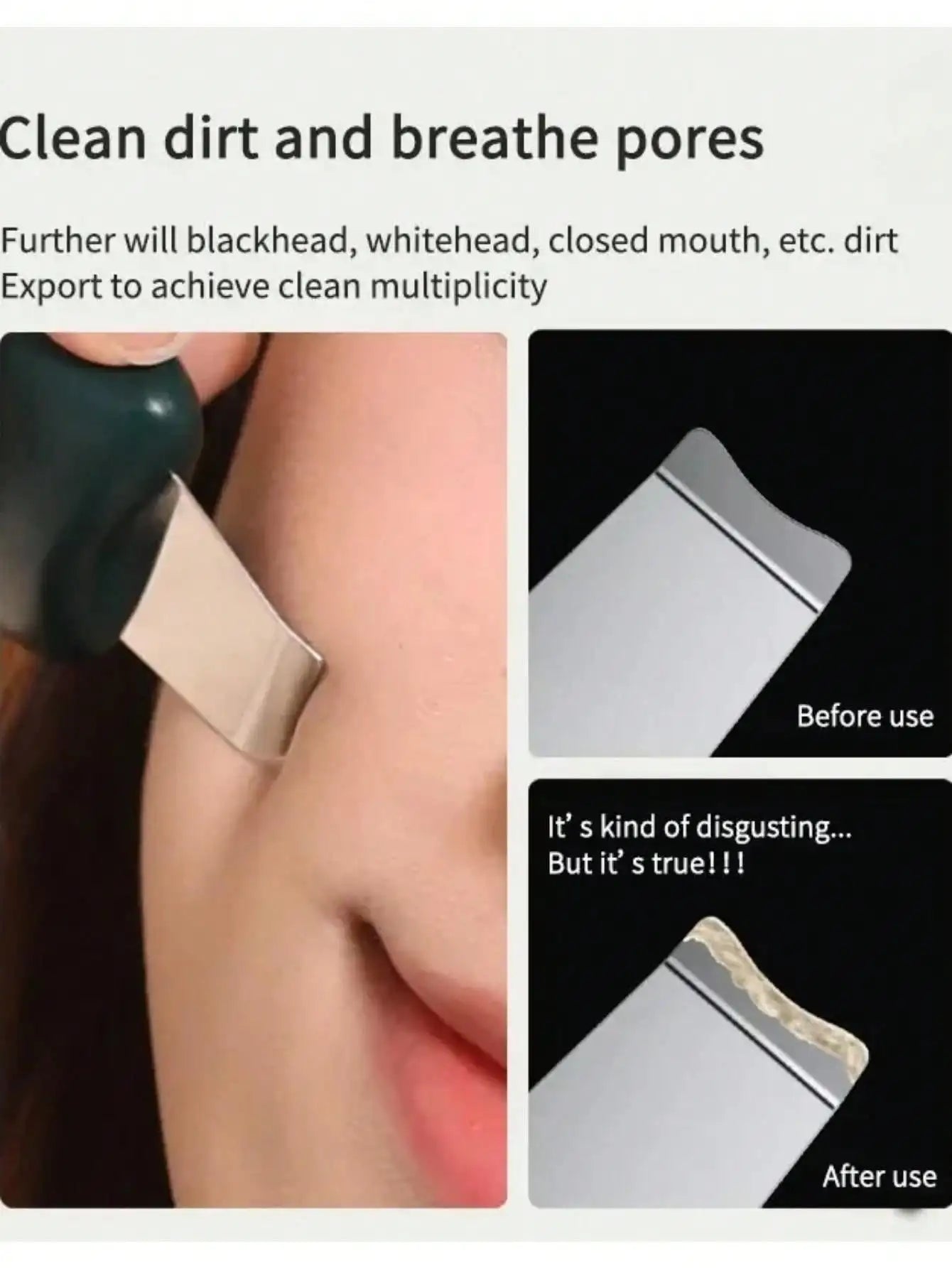Facial Skin Scrubber & Pore Cleaner