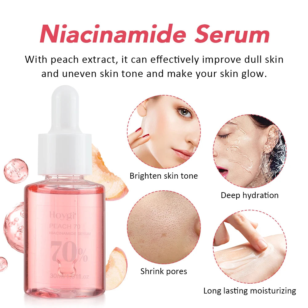 30ml Niacinamide Serum – Melanin Removal & Pore Shrinking